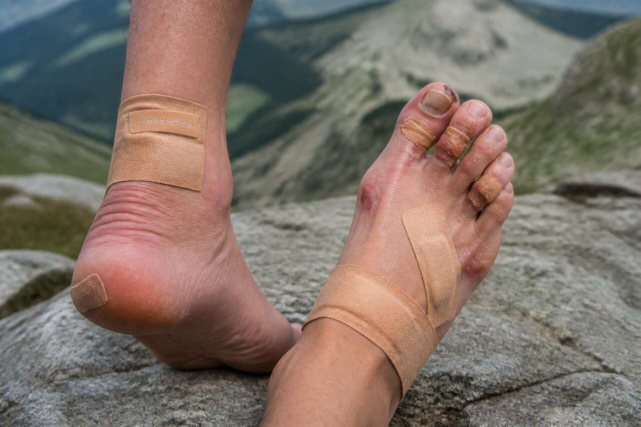 Ampoules, ongles, crevasses: premiers secours et soins apr&egrave;s l&rsquo;&eacute;tape